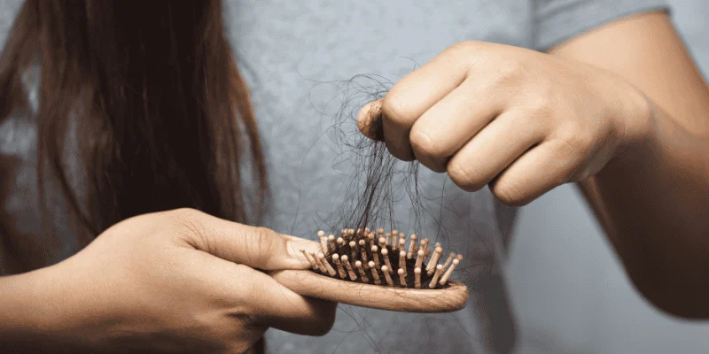 Does PCOS Hair Loss grow back