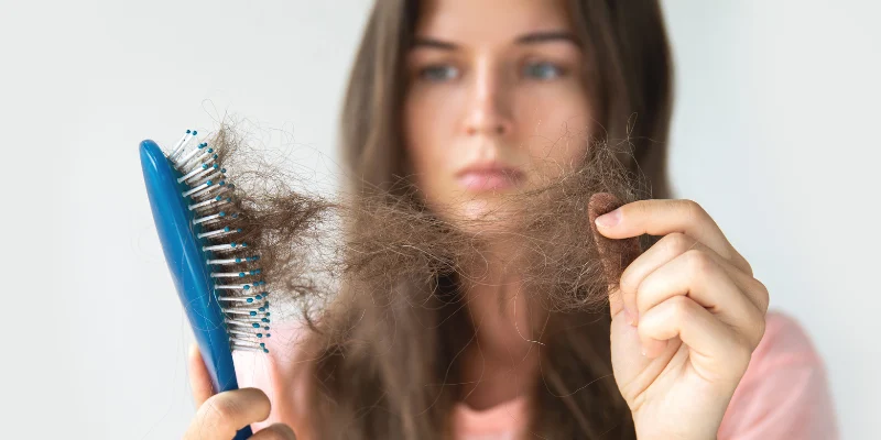 Thyroid and Female Pattern Hair Loss