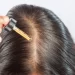 How Minoxidil Actually Works on Your Hair