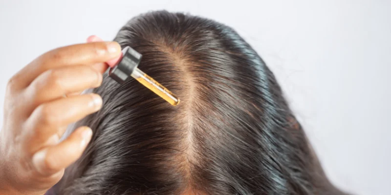How Minoxidil Actually Works on Your Hair