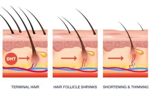 Hair Fall Causes in Men: What’s Really Behind It?