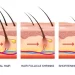 Hair Fall Causes in Men: What’s Really Behind It?