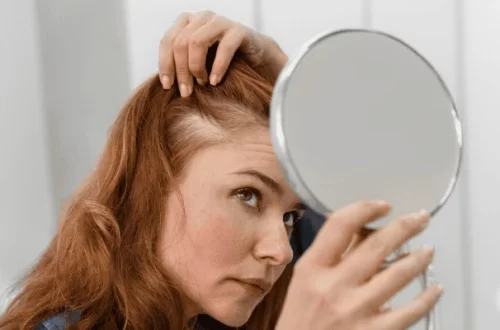 The Emotional Impact of PCOS Hair Loss