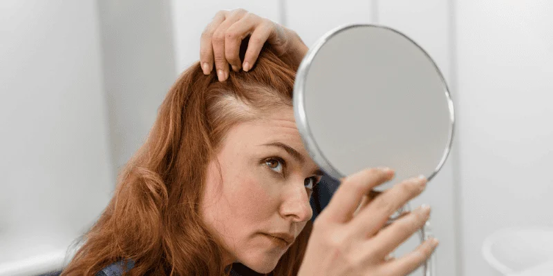 The Emotional Impact of PCOS Hair Loss