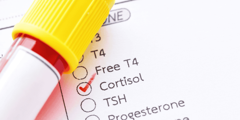 Key Hormones That Affect Your Hair