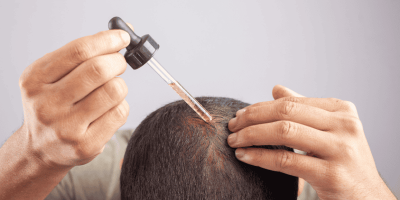 What is Minoxidil and How Does It Work